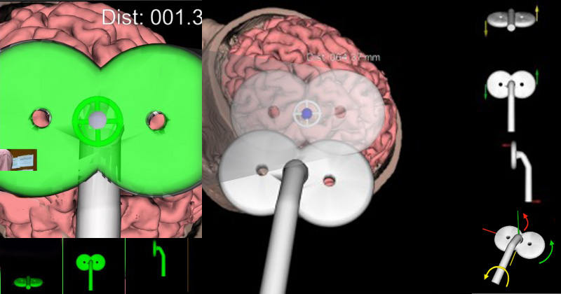 InVesalius pode ser associado a diferentes equipamentos e o seu código é livre e aberto, podendo ser alterado por qualquer pessoa para fins específicos – Imagem: Reprodução/Journal of Neuroscience Methods